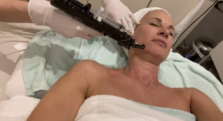 Mesotherapie